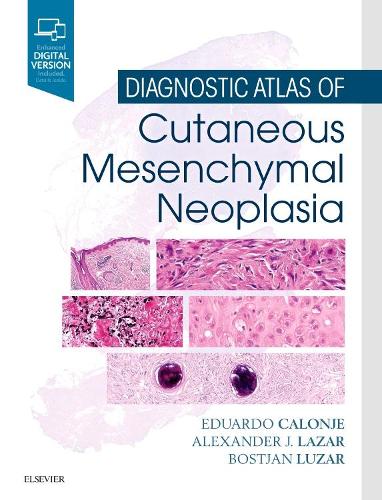 Паперова книга «Diagnostic Atlas of Cutaneous Mesenchymal Neoplasia», авторів Александер Дж. Лазар, Бостян Лузар, Х. Едуардо Калоньє - фото №1