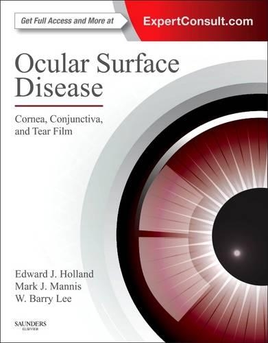 Паперова книга «Ocular Surface Disease: Cornea, Conjunctiva and Tear Film: Expert Consult - Online and Print», авторів Едвард Дж. Голланд, Марк Дж. Манніс, У. Баррі Лі - фото №1