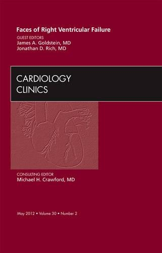 Паперова книга «Faces of Right Ventricular Failure, An Issue of Cardiology Clinics», авторів Джеймс А. Гольдштейн, Джонатан Д. Річ - фото №1