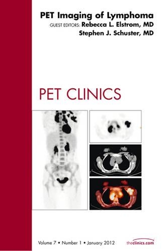 Паперова книга «PET Imaging of Lymphoma, An Issue of PET Clinics», авторів Ребекка Ельстром, Стівен Шустер - фото №1