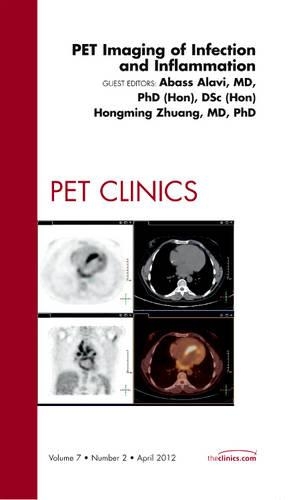 Бумажная книга «PET Imaging of Infection and Inflammation, An Issue of PET Clinics», авторов Абасс Алави, Хунмин Чжуан - фото №1