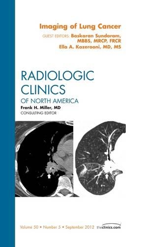 Бумажная книга «Imaging of Lung Cancer, An Issue of Radiologic Clinics of North America», авторов Баскаран Сундарам, Элла А. Казеруни - фото №1