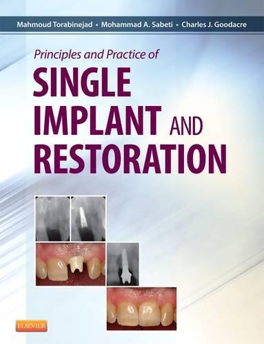 Паперова книга «Principles and Practice of Single Implant and Restoration», авторів Чарльз Гудакр, Махмуд Торабінеджад, Мохаммед Сабеті - фото №1