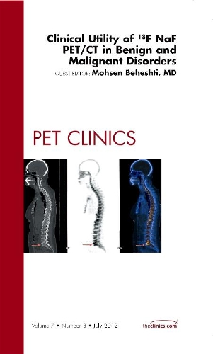 Бумажная книга «Clinical Utility of 18NaF PET/CT in Benign and Malignant Disorders, An Issue of PET Clinics», автор Мохсен Бехешти - фото №1