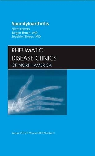Бумажная книга «Spondyloarthropathies, An Issue of Rheumatic Disease Clinics», авторов Иоахим Зипер, Юрген Браун - фото №1