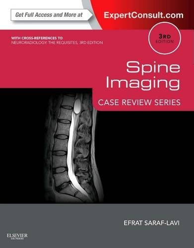 Бумажная книга «Spine Imaging: Case Review Series: Expert Consult - Online and Print», автор Эфрат Сараф-Лави - фото №1