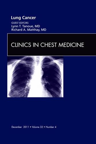 Бумажная книга «Lung Cancer, An Issue of Clinics in Chest Medicine», авторов Линн Т. Тануе, Ричард А. Мэттэй - фото №1