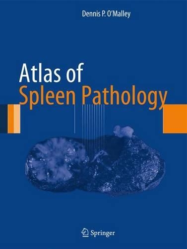 Бумажная книга «Atlas of Spleen Pathology», автор Деннис П. О'Мэлли - фото №1
