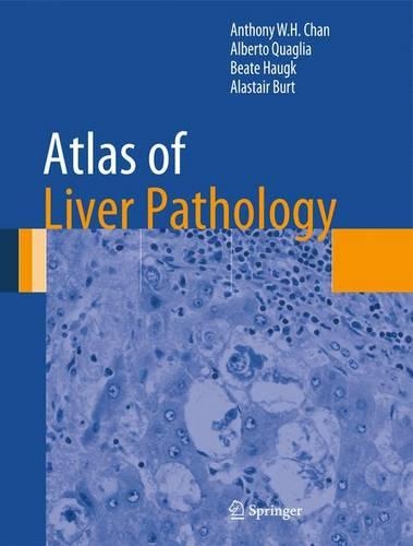 Паперова книга «Atlas of Liver Pathology», авторів Аластер Берт, Альберто Куалья, Ентоні В.Х. Чан, Беата Хаугк - фото №1