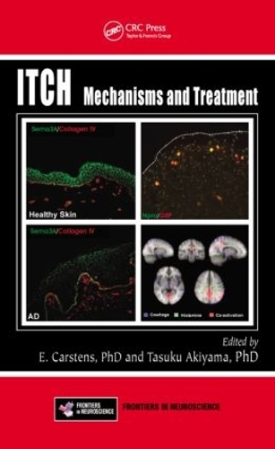 Паперова книга «Itch: Mechanisms and Treatment» - фото №1