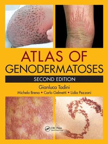 Паперова книга «Atlas of Genodermatoses», авторів Карло Джельметті, Джанлука Тадіні, Лідія Пеццані, Мікела Брена - фото №1