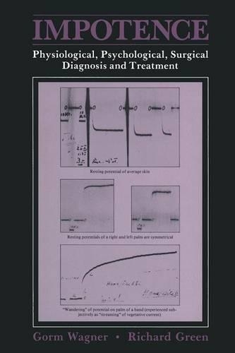 Паперова книга «Impotence: Physiological, Psychological, Surgical Diagnosis and Treatment», автор Горм Вагнер - фото №1
