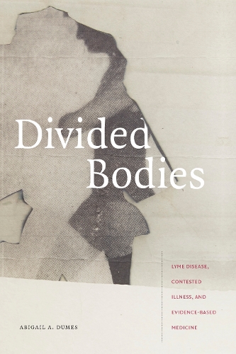 Паперова книга «Divided Bodies: Lyme Disease, Contested Illness, and Evidence-Based Medicine», автор Ебігейл А. Думс - фото №1