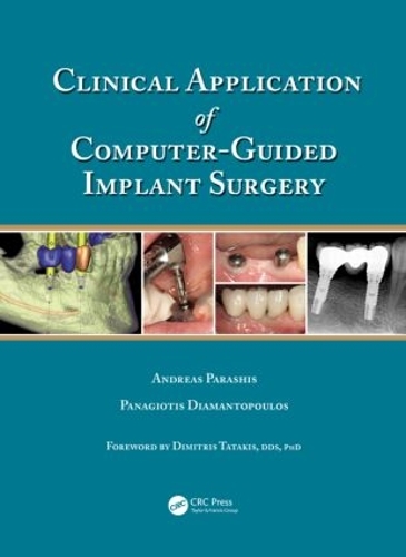 Бумажная книга «Clinical Application of Computer-Guided Implant Surgery», авторов Андреас Парашис, Панагиотис Диамантопулос - фото №1