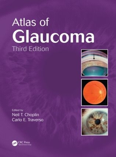 Бумажная книга «Atlas of Glaucoma» - фото №1