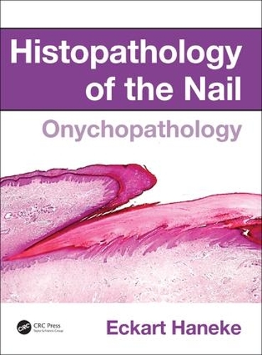 Бумажная книга «Histopathology of the Nail: Onychopathology», автор Экарт Ханеке - фото №1
