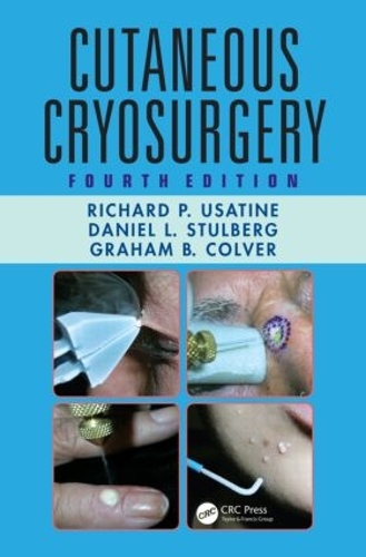 Бумажная книга «Cutaneous Cryosurgery», автор Грэм Б. Колвер - фото №1