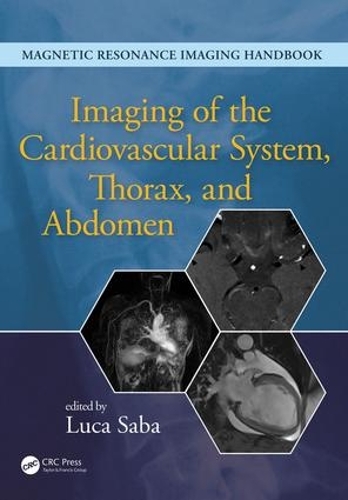 Бумажная книга «Imaging of the Cardiovascular System, Thorax, and Abdomen» - фото №1