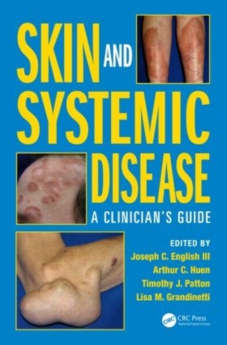 Бумажная книга «Skin and Systemic Disease: A Clinician's Guide», авторов Джозеф К. Инглиш III, Тимоти Дж. Паттон - фото №1