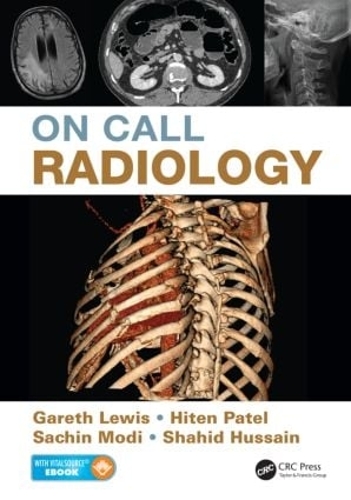 Бумажная книга «On Call Radiology», авторов Гарет Льюис, Хитен Патель, Сачин Моди, Шахид Хусейн - фото №1
