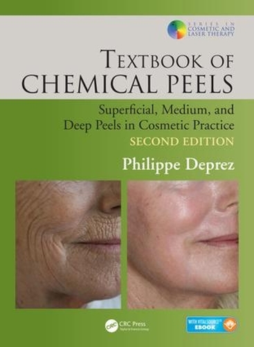 Бумажная книга «Textbook of Chemical Peels: Superficial, Medium, and Deep Peels in Cosmetic Practice», автор Филипп Депре - фото №1