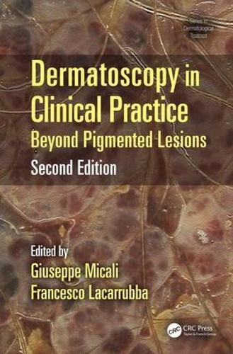 Бумажная книга «Dermatoscopy in Clinical Practice: Beyond Pigmented Lesions» - фото №1