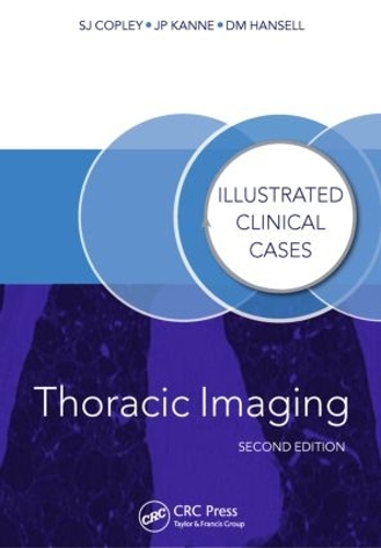 Бумажная книга «Thoracic Imaging: Illustrated Clinical Cases, Second Edition», авторов Дэвид Ханселл, Джеффри Канн, Сью Копли - фото №1