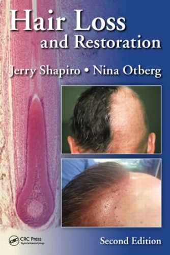 Паперова книга «Hair Loss and Restoration», авторів Джеррі Шапіро, Ніна Отберг - фото №1