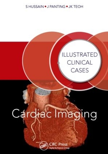 Бумажная книга «Cardiac Imaging: Illustrated Clinical Cases», авторов Джонатан Пантинг, Джун Киат Теох, Шахид Хусейн - фото №1