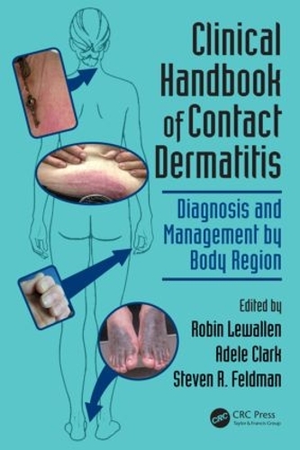 Бумажная книга «Clinical Handbook of Contact Dermatitis: Diagnosis and Management by Body Region» - фото №1