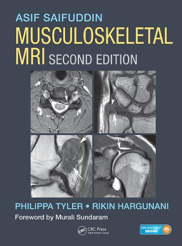 Паперова книга «Musculoskeletal MRI», авторів Асіф Сайфуддін, Філіппа Тайлер, Рікін Харгунані - фото №1