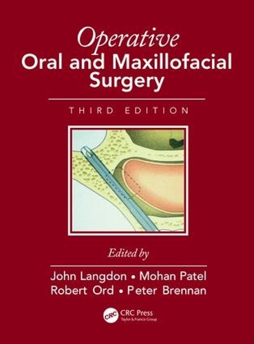Паперова книга «Operative Oral and Maxillofacial Surgery» - фото №1
