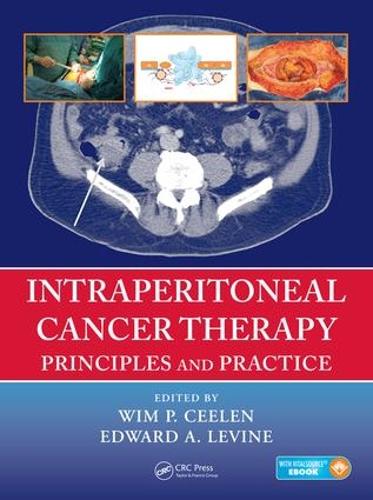 Бумажная книга «Intraperitoneal Cancer Therapy: Principles and Practice» - фото №1