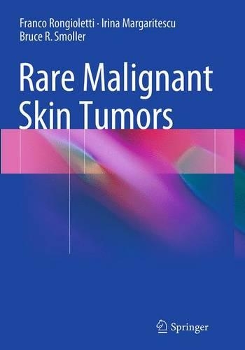 Паперова книга «Rare Malignant Skin Tumors», авторів Брюс Р. Смоллер, Франко Ронгіолетті, Ірина Маргаритеску - фото №1