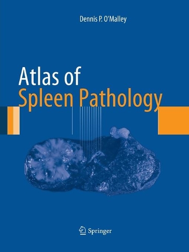 Бумажная книга «Atlas of Spleen Pathology», автор Деннис П. О'Мэлли - фото №1