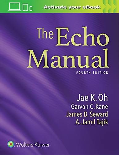 Бумажная книга «The Echo Manual», авторов Гарван К. Кейн, Чжэ К. О - фото №1