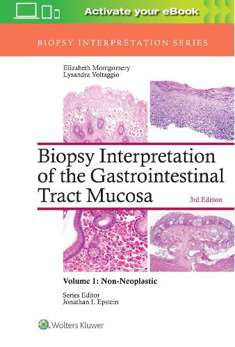 Бумажная книга «Biopsy Interpretation of the Gastrointestinal Tract Mucosa: Volume 1: Non-Neoplastic», авторов Элизабет А. Монтгомери, Лисандра Вольтаджио - фото №1