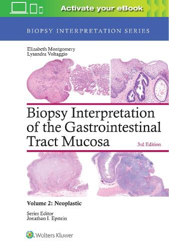 Бумажная книга «Biopsy Interpretation of the Gastrointestinal Tract Mucosa: Volume 2: Neoplastic», авторов Элизабет А. Монтгомери, Лисандра Вольтаджио - фото №1