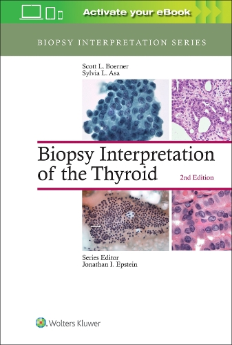 Paper book «Biopsy Interpretation of the Thyroid», authors Scott L. Boerner, Sylvia L. Asa - фото №1