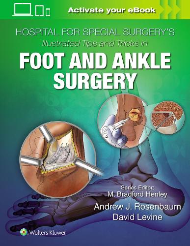 Бумажная книга «Hospital for Special Surgery's Illustrated Tips and Tricks in Foot and Ankle Surgery», автор Дэвид Левин - фото №1