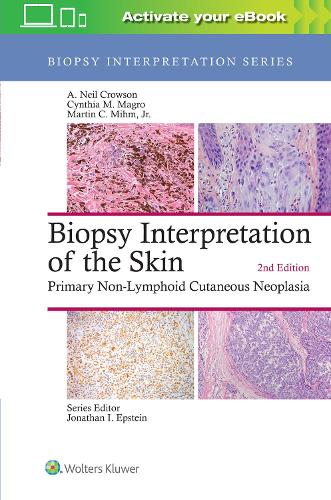 Бумажная книга «Biopsy Interpretation of the Skin: Primary Non-Lymphoid Cutaneous Neoplasia», авторов А. Нил Кроусон, Синтия М. Магро - фото №1