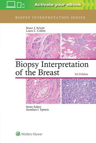 Бумажная книга «Biopsy Interpretation of the Breast», авторов Лаура К. Коллинз, Стюарт Дж. Шнитт - фото №1