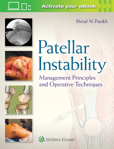 Бумажная книга «Patellar Instability: Management Principles and Operative Techniques» - фото №1