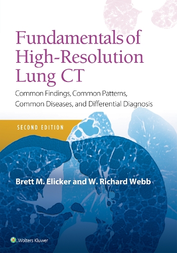 Бумажная книга «Fundamentals of High-Resolution Lung CT: Common Findings, Common Patterns, Common Diseases and Differential Diagnosis», авторов Бретт М Эликер, В. Ричард Вебб - фото №1