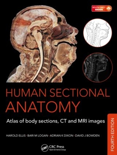 Бумажная книга «Human Sectional Anatomy: Atlas of Body Sections, CT and MRI Images, Fourth Edition», авторов Адриан К. Диксон, Бари М. Логан, Дэвид Дж. Боуден, Гарольд Эллис - фото №1