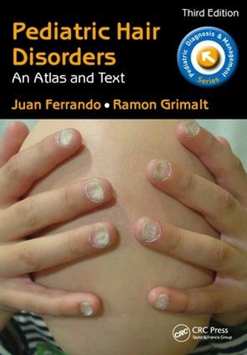 Бумажная книга «Pediatric Hair Disorders: An Atlas and Text, Third Edition», авторов Хуан Феррандо, Рамон Гримальт - фото №1