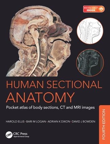 Бумажная книга «Human Sectional Anatomy: Pocket atlas of body sections, CT and MRI images, Fourth edition», авторов Адриан Кендал Диксон, Бари М. Логан, Дэвид Дж. Боуден, Гарольд Эллис - фото №1