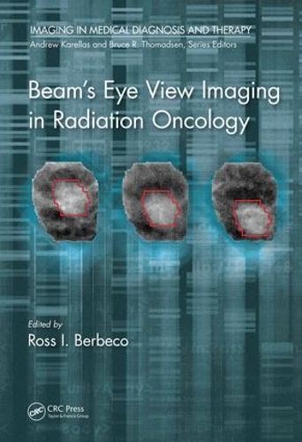 Бумажная книга «Beam's Eye View Imaging in Radiation Oncology» - фото №1