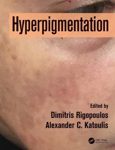 Бумажная книга «Hyperpigmentation» - фото №1