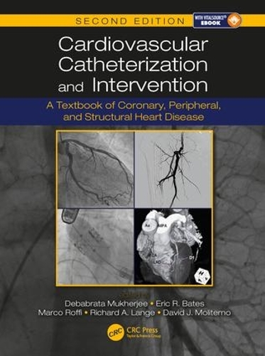 Бумажная книга «Cardiovascular Catheterization and Intervention: A Textbook of Coronary, Peripheral, and Structural Heart Disease, Second Edition» - фото №1